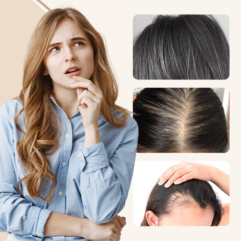 💇♀️ 50% DE RÉDUCTION MAINTENANT ! 🔥 Postiche à Frange Partielle – Volume Instantané, Aspect Naturel & Facile à Clipser ⚡