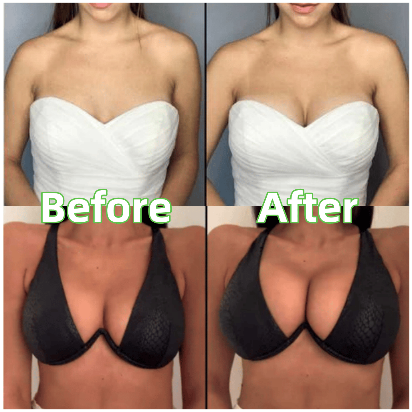 🔥 ACHETEZ 1, OBTENEZ 1 GRATUITEMENT 🔥Insère de levage invisible à adhésif double face