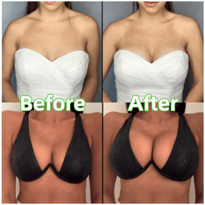 🔥 ACHETEZ 1, OBTENEZ 1 GRATUITEMENT 🔥Insère de levage invisible à adhésif double face
