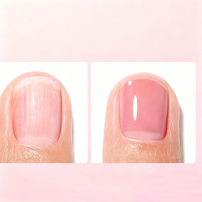 🥛 Fortifiant professionnel pour ongles à la protéine de lait – Renforce, nourrit et protège, le soin naturel pour des ongles visiblement plus forts et en meilleure santé, sans produits agressifs 🌿💎