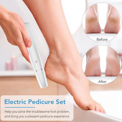 🔥 VENTE FLASH -50% ! ✨ Ponceuse Électrique pour Pieds – Peau Douce et Sain