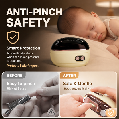 🎉 Soldes 2026 – Plus de 113 000 exemplaires vendus ! ✂️ Coupe-ongles électrique intelligent 2‑en‑1 et polisseur – Sécurité anti‑pincement et lumière LED 💅