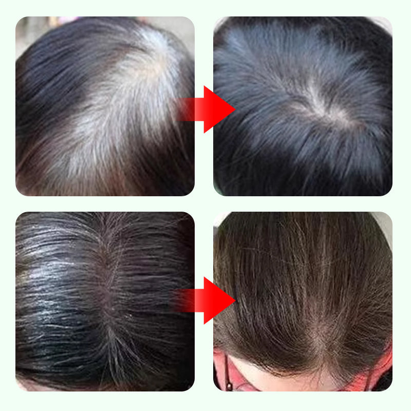 💇‍♀️ Achetez 1, Obtenez 1 Gratuit ✨ Stylo Anti-Racines 10 Secondes - Jeunesse Instantanée en un Clic ! ✨