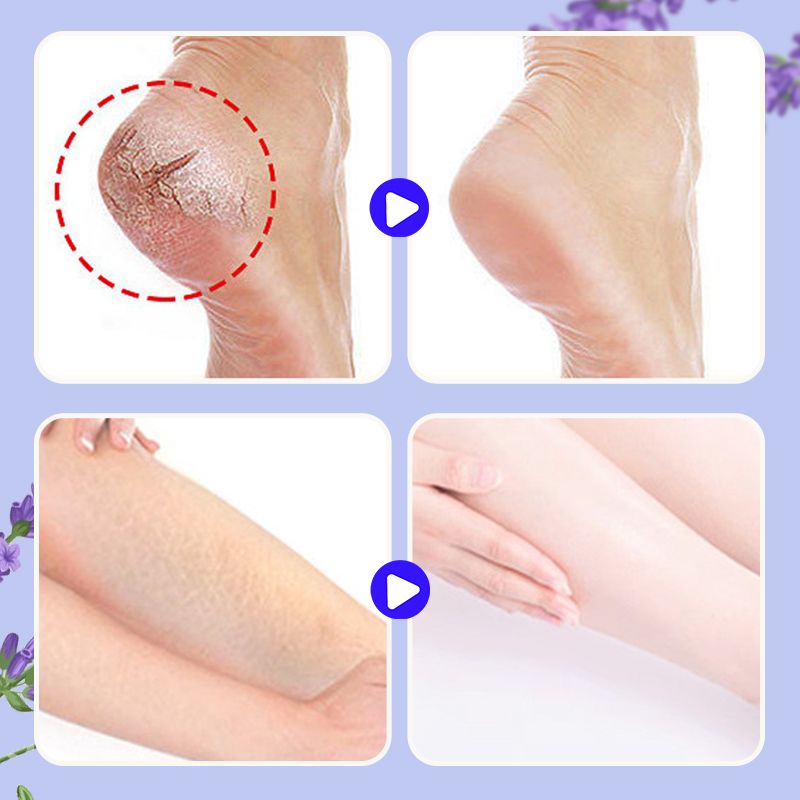 👣💙 Baume réparateur pieds anti-crevasses — Nourrit & adoucit ! 🎁 Offre spéciale : 2 achetés = 1 offert !