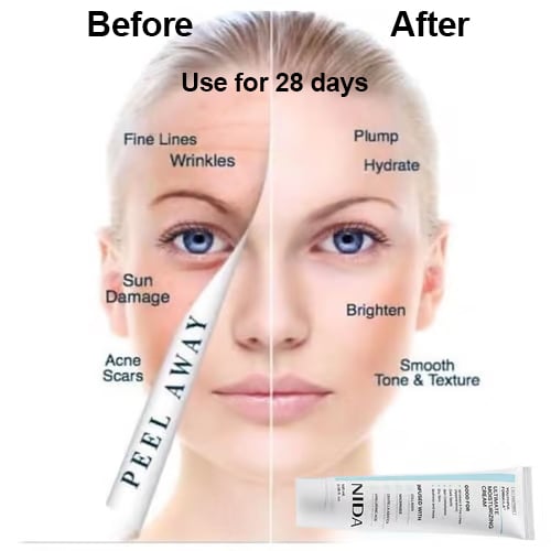 🥳VENTE EXCEPTIONNELLE 2026🥳💞Plus de 50 000 unités vendues !🌿💧 50 % de réduction ! Formule Jeunesse NIDA – La Centella Asiatica apaise, le Bifida renforce. Atténue les rides, redonne de l’éclat. 🔥💝