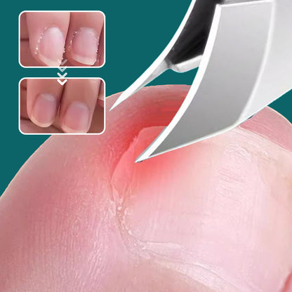 🔥2026 Vente à chaud🔥 Set de 3 pièces de coupe-ongles à bord incliné 25° anti-éclaboussures