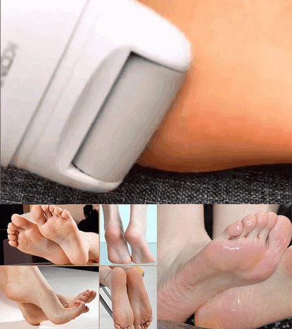 💥Offre à durée limitée💥Extracteur électrique rechargeable de callosités plantaires