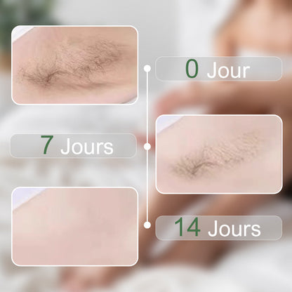 🔥Achetez-en 2 et obtenez-en 1 gratuitement 🎁Crème dépilatoire douce pour hommes et femmes