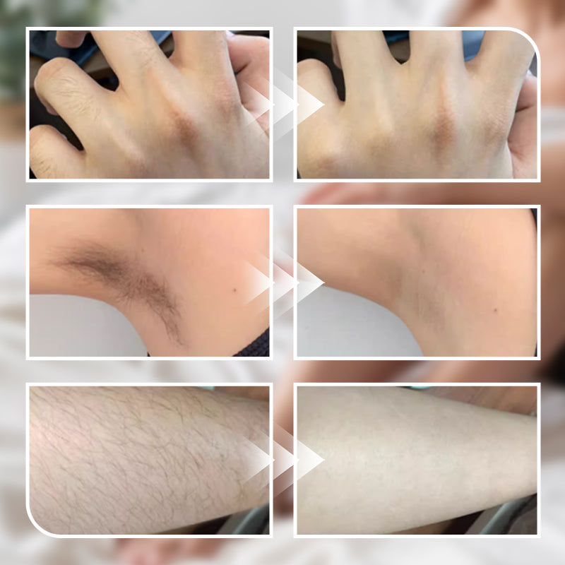 🔥Achetez-en 2 et obtenez-en 1 gratuitement 🎁Crème dépilatoire douce pour hommes et femmes