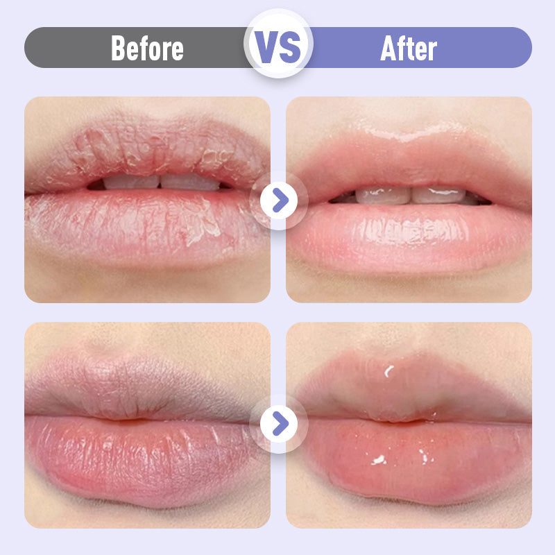 ⏳Spécial à durée limitée⏰Sérum Hydratant Repulpant et Anti-Rides pour les Lèvres💋Oferta por tempo limitado: compre um e ganhe outro grátis