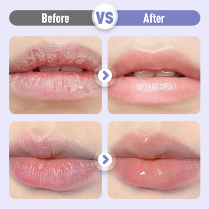 👑Sérum Hydratant Repulpant et Anti-Rides pour les Lèvres💋✨