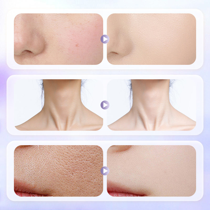 🔥 Offre limitée – 75 % de réduction ! 🎉 Crème visage légère et longue tenue pour une peau lumineuse et éclatante