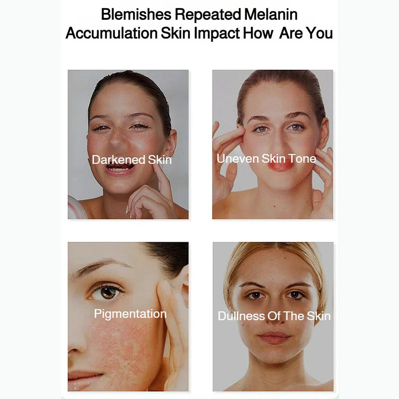 💥Spray éclaircissant et correcteur de taches pour un teint éclatant| Achetez 2，Obtenez 1 Gratuit 😍