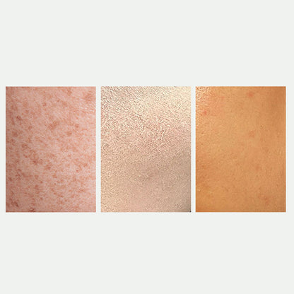 💥Spray éclaircissant et correcteur de taches pour un teint éclatant| Achetez 2，Obtenez 1 Gratuit 😍