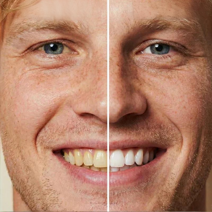 🦷 ACHETEZ 2, OFFERT 1! ✨ Peinture Dentaire Blanchissante 5 ml – Effet Instantané, Facile à Appliquer & Durée Longue 💎