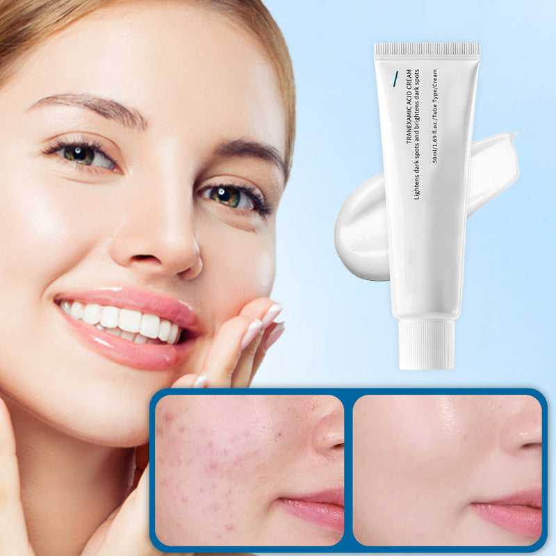 🧴✨ 2026 NOUVELLE VERSION ! Crème Hydratante Correctrice des Taches Brunes | Anti-Taches & Éclat | Qualité Supérieure 💎