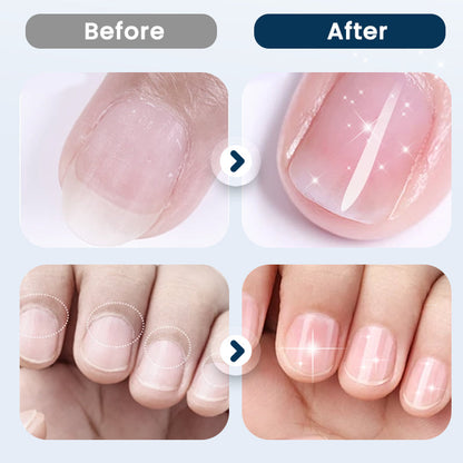 💅🧴 PROMO Spray réparateur nourrissant pour ongles fragiles ✨