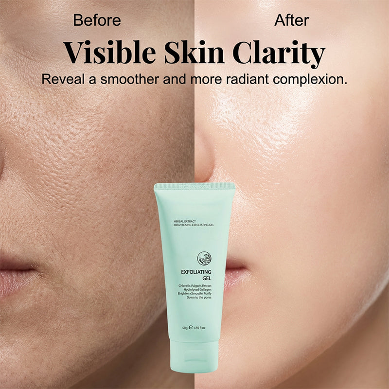 🏆 Offre spéciale du dernier jour : 5,99 € ! 🔥 2 achetés, le 3e offert 🎁 Gel exfoliant éclaircissant aux extraits de plante – Formule douce végétale, exfoliation efficace & soin unifiant pour la peau 🧴